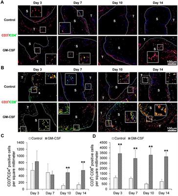 Immune evaluation of granulocyte-macrophage colony stimulating factor loaded hierarchically 3D nanofiber scaffolds in a humanized mice model